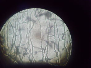 食品微生物检测 如何初步识别霉菌孢子